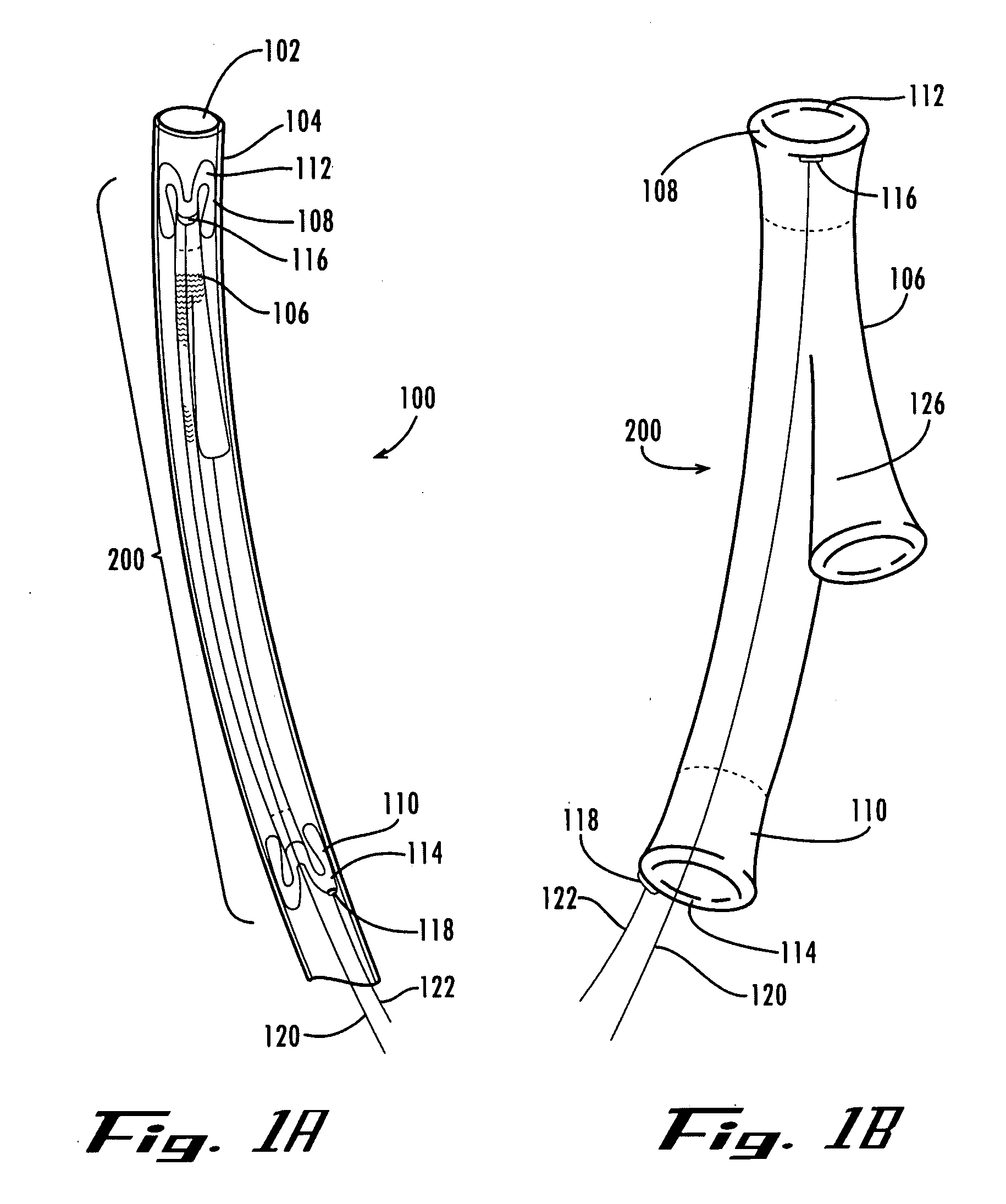 Sealable endovascular implants and methods for their use