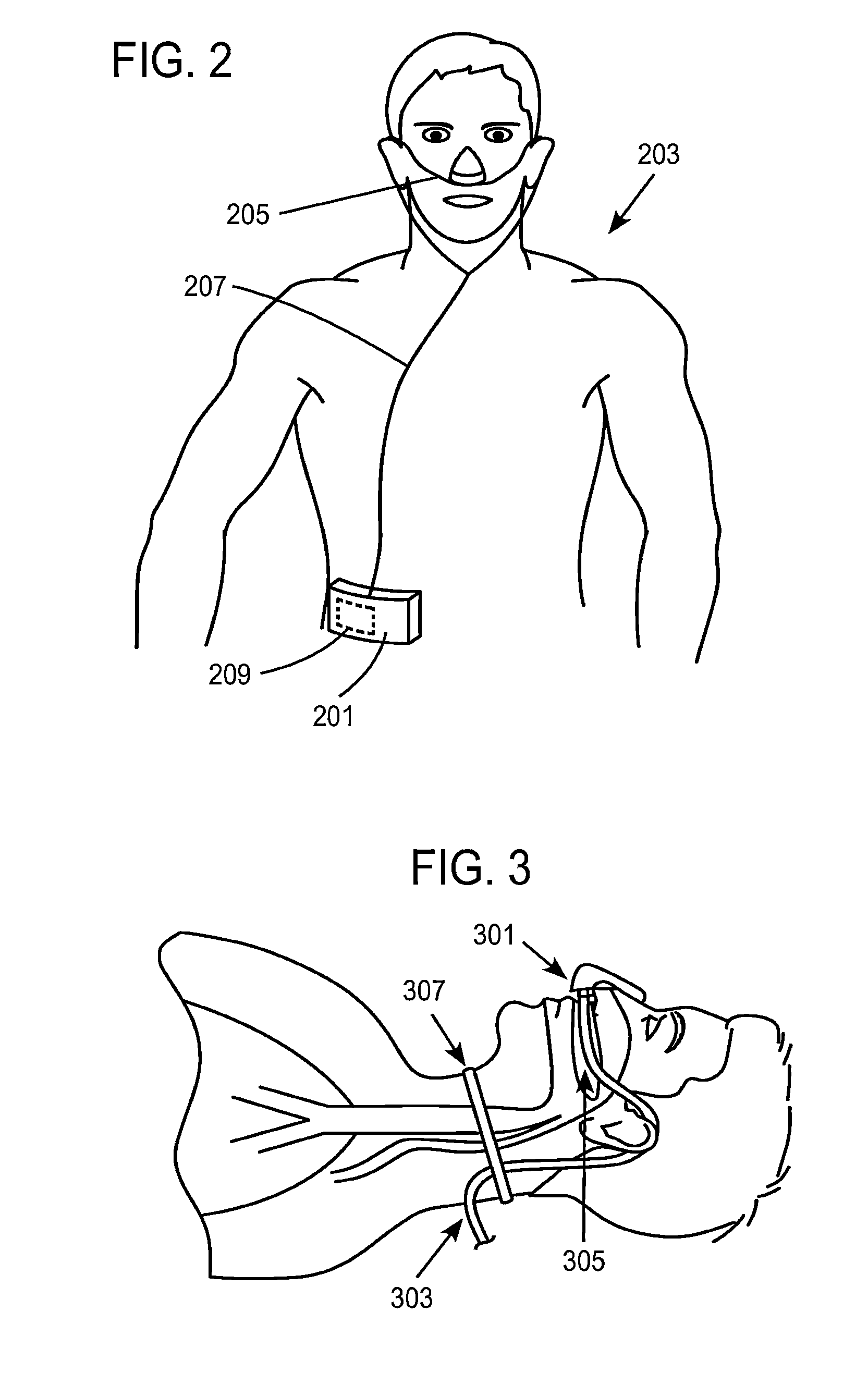 Methods, Systems and Devices for Non-Invasive Open Ventilation For Providing Ventilation Support