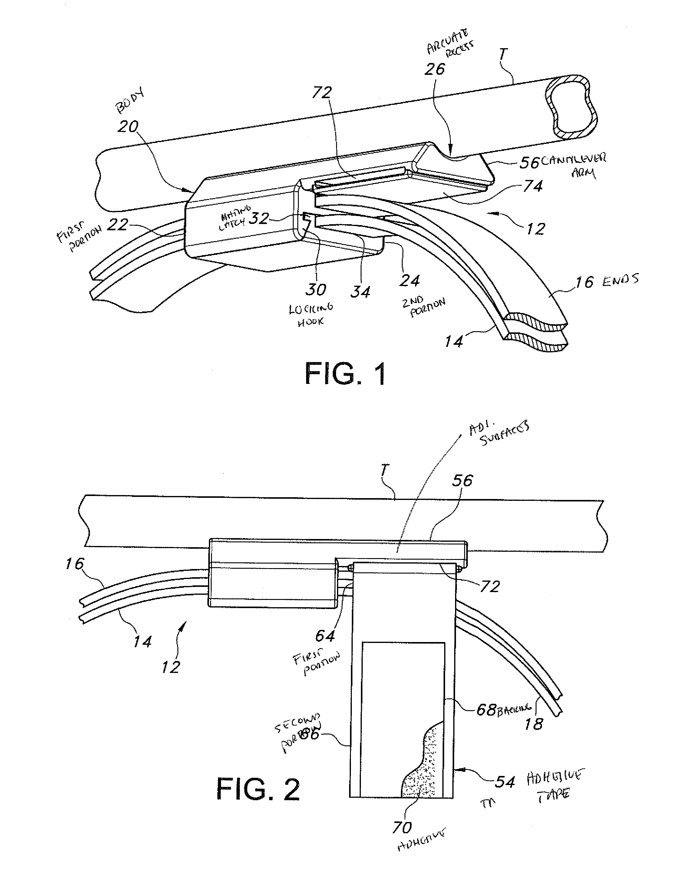 Bridle system for placing and securing a nasal tube in a patient