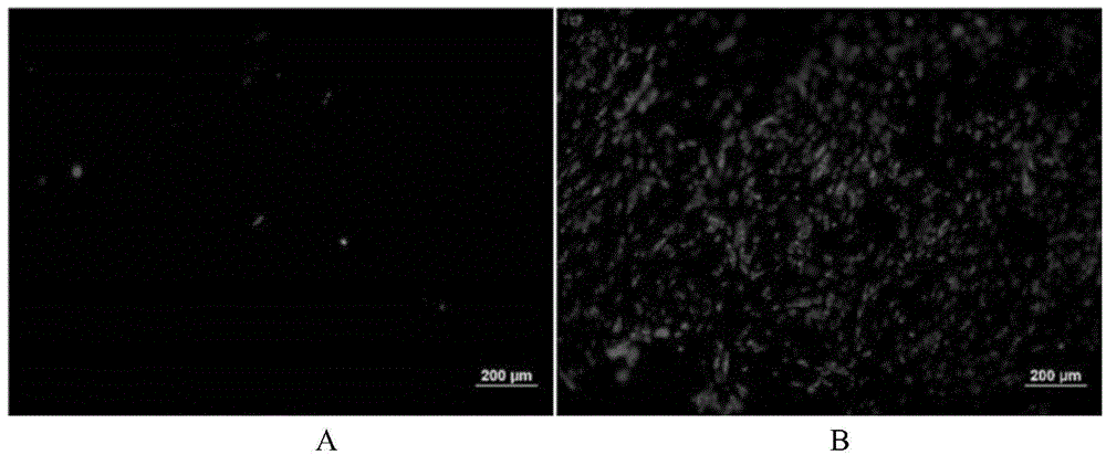 Polysaccharide-dopamine composite biogel and application thereof