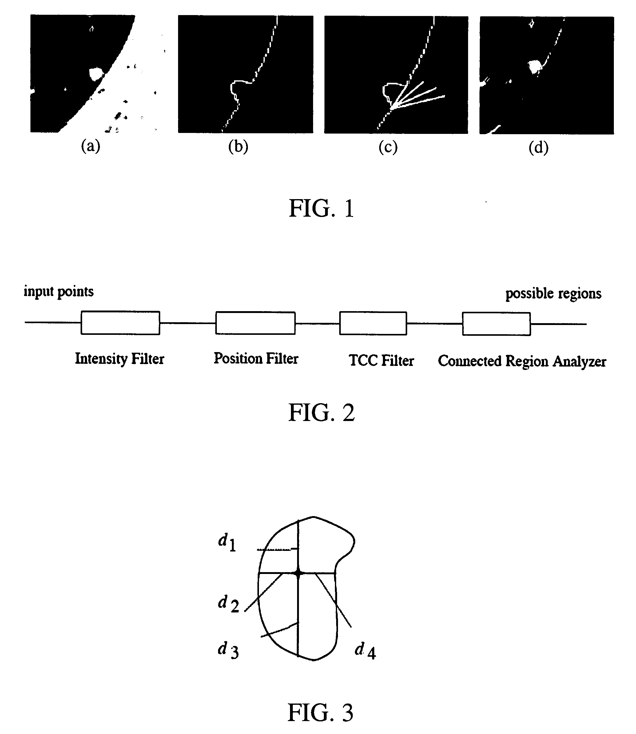 Registration System and Method For Tracking Lung Nodules In Medical Images