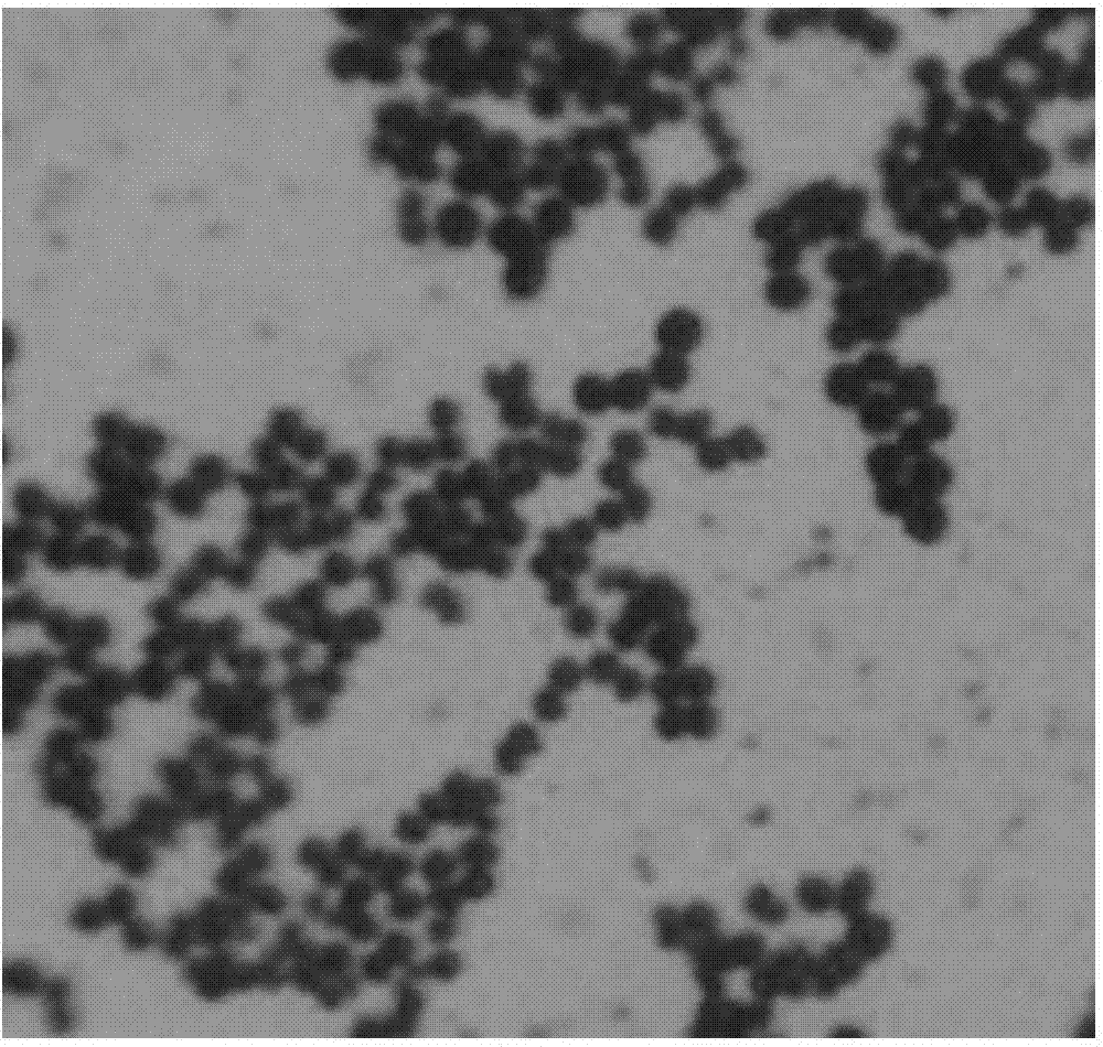 Staphylococcus epidermidis and application thereof