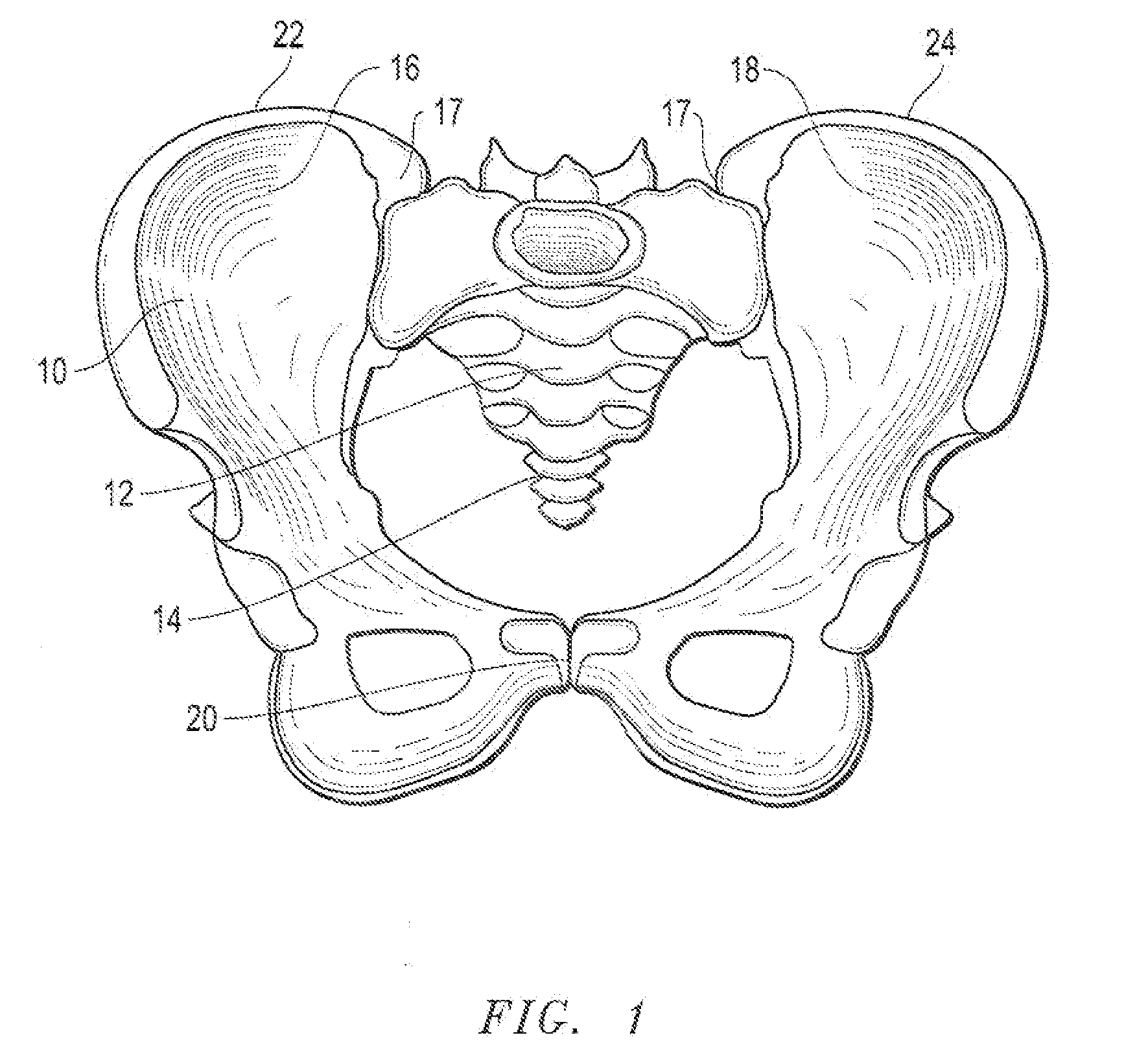 Adjustable pelvic compression belt and methods for reducing the width of, and/or realigning, a user's hips