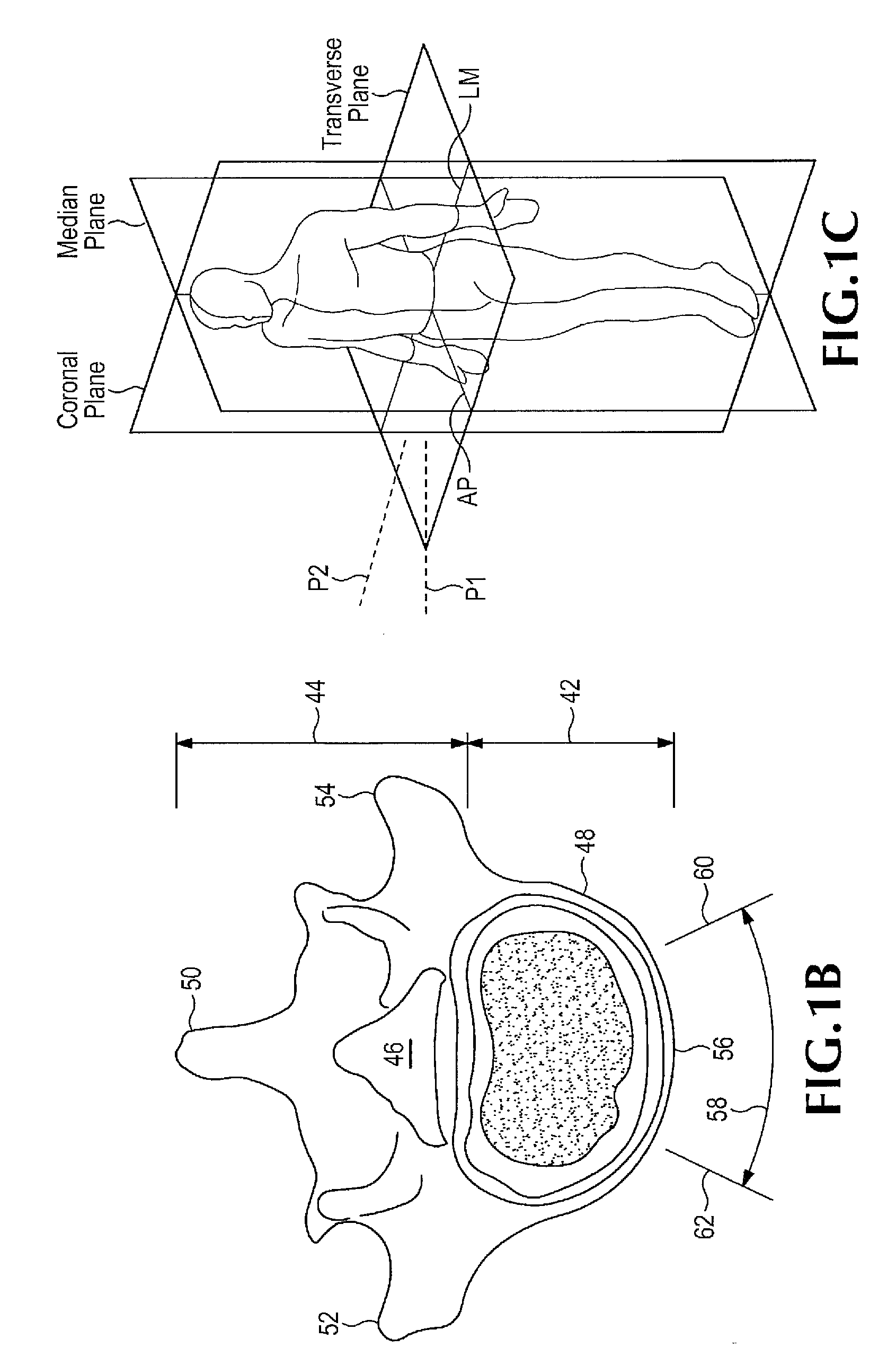 Insertion device for use during retroperitoneal lateral insertion of spinal implants