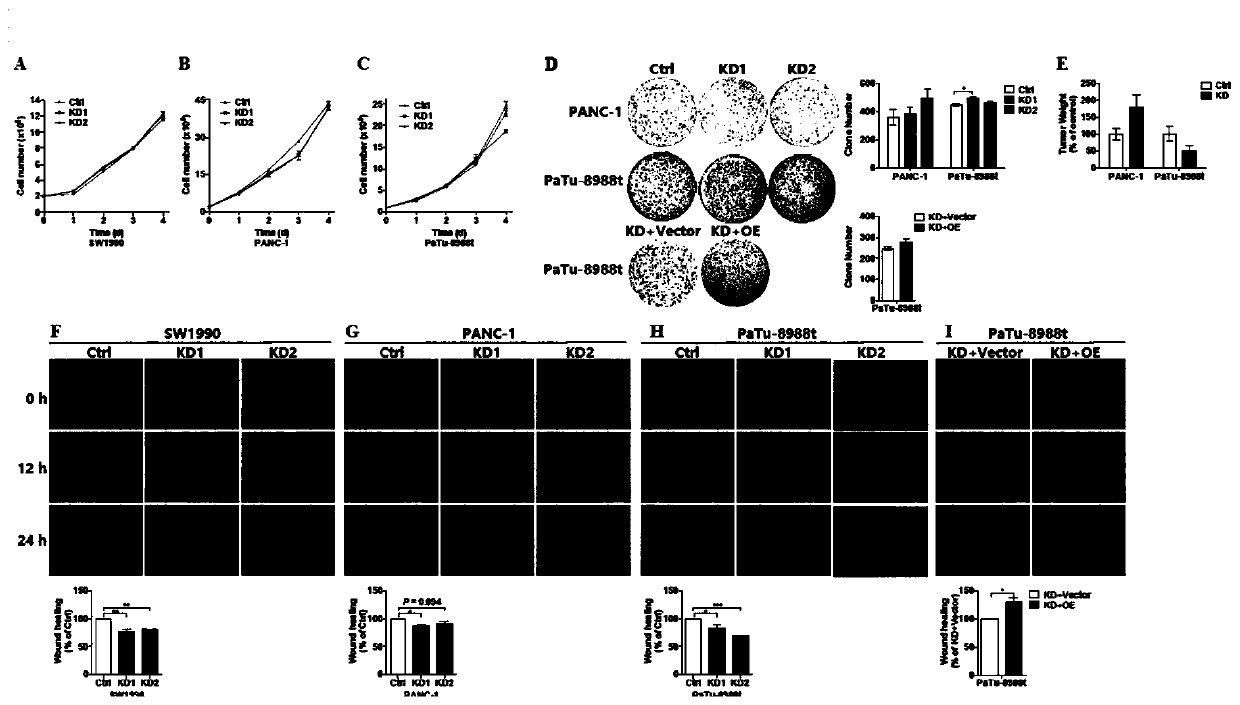 Application of metformin-targeted COX6B2 in preparation of medicine for treating pancreatic cancer