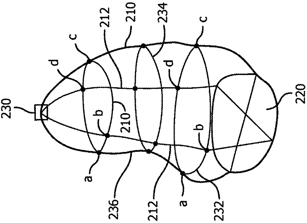 Ultrasonic cardiac assessment of hearts with medial axis curvature and transverse eccentricity