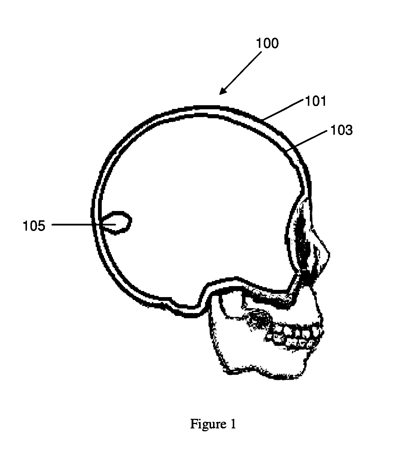 Method for manufacturing a three-dimensional anatomical structure