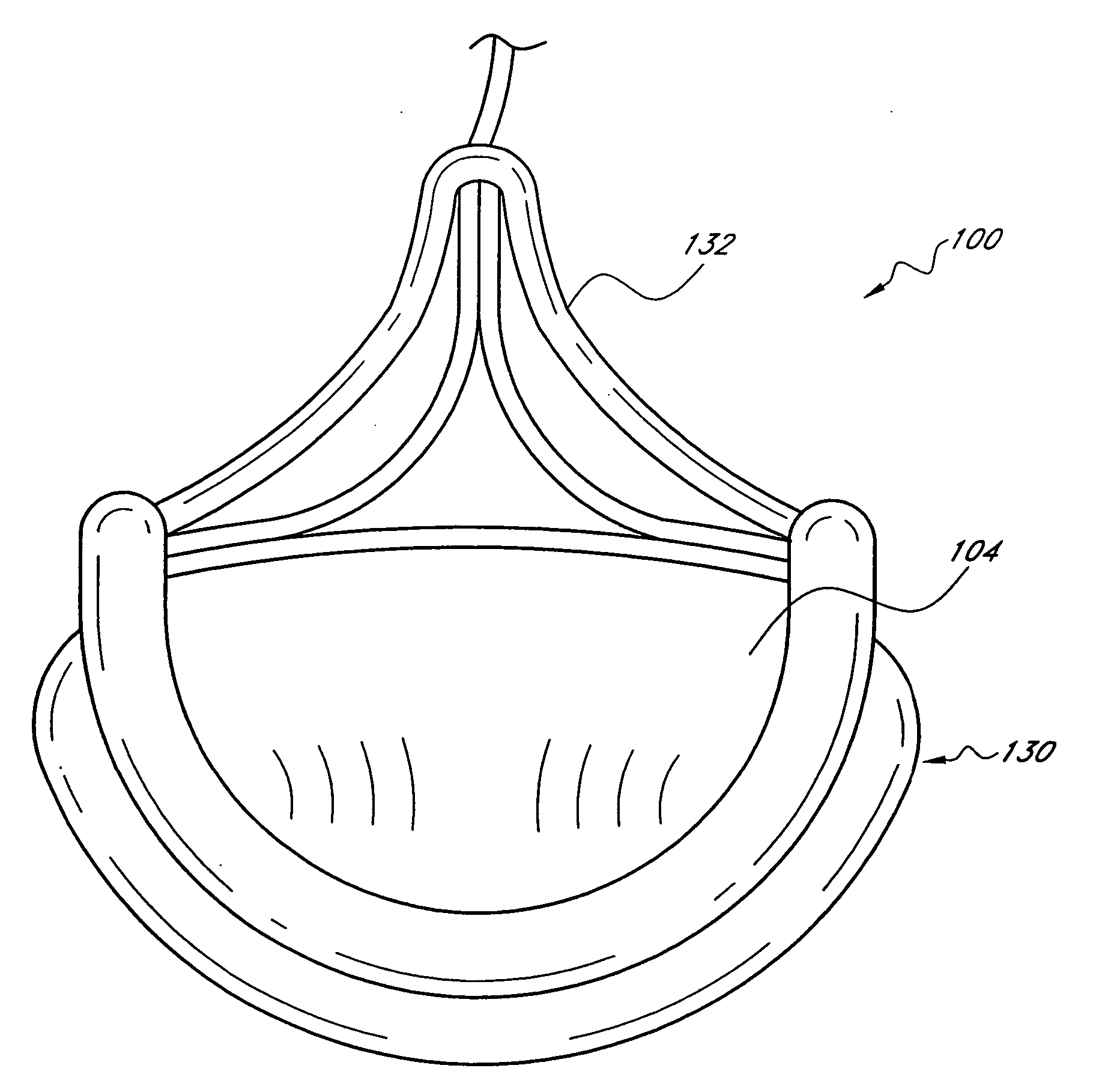 Translumenally implantable heart valve with formed in place support
