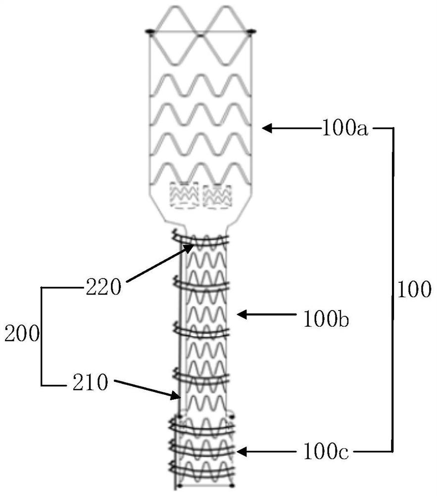 Covered stent system