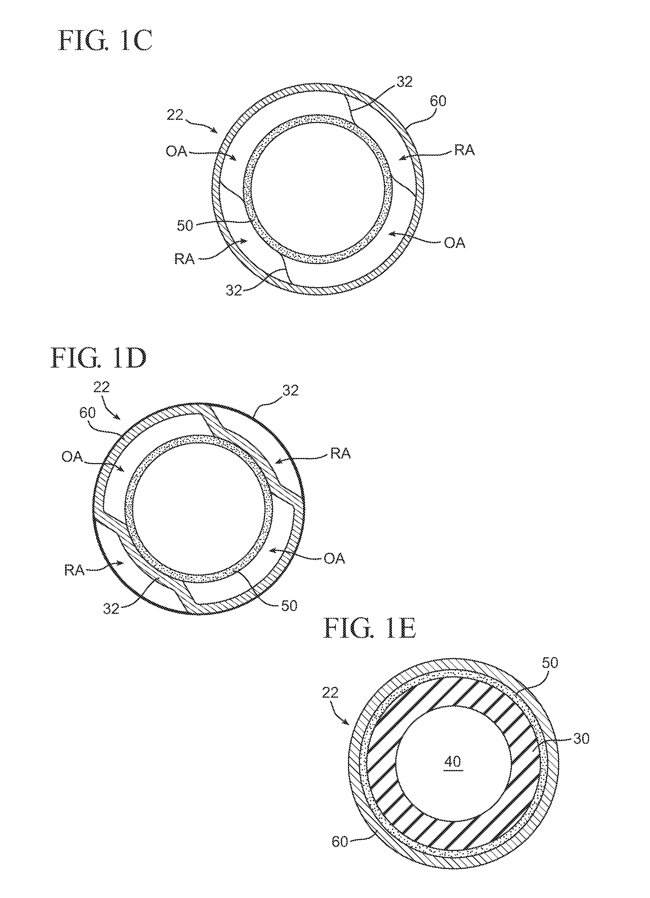Fluid filled implants for treating medical conditions