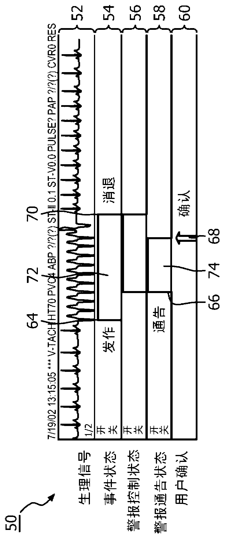 Method for display and navigation to clinical events