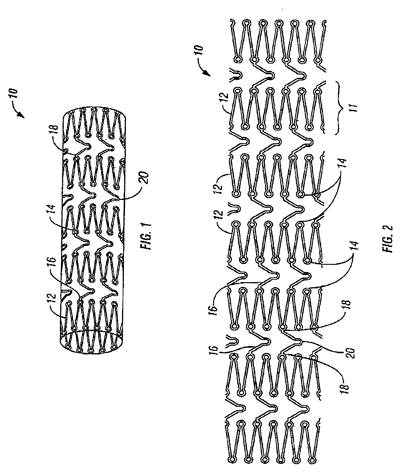 Implantable expandable medical devices having regions of differential mechanical properties and methods of making same