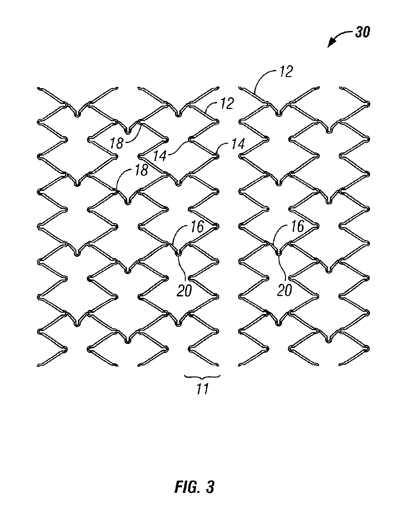 Implantable expandable medical devices having regions of differential mechanical properties and methods of making same