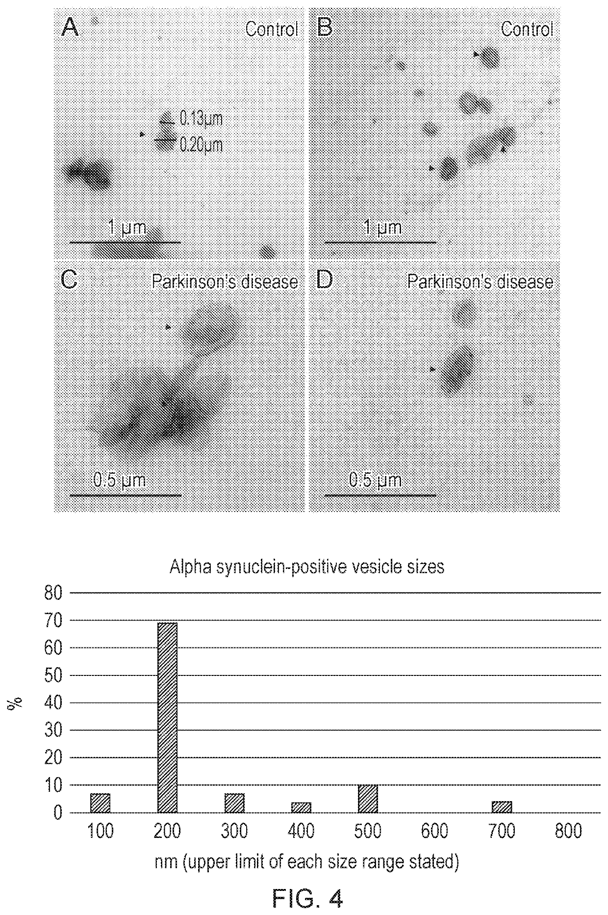 Detection of pathological protein aggregation