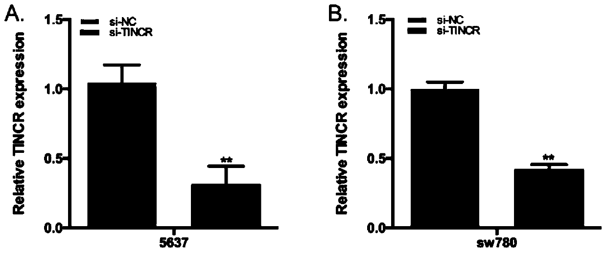 A kind of theophylline-induced RNA interference switch system and its gene regulation method and application