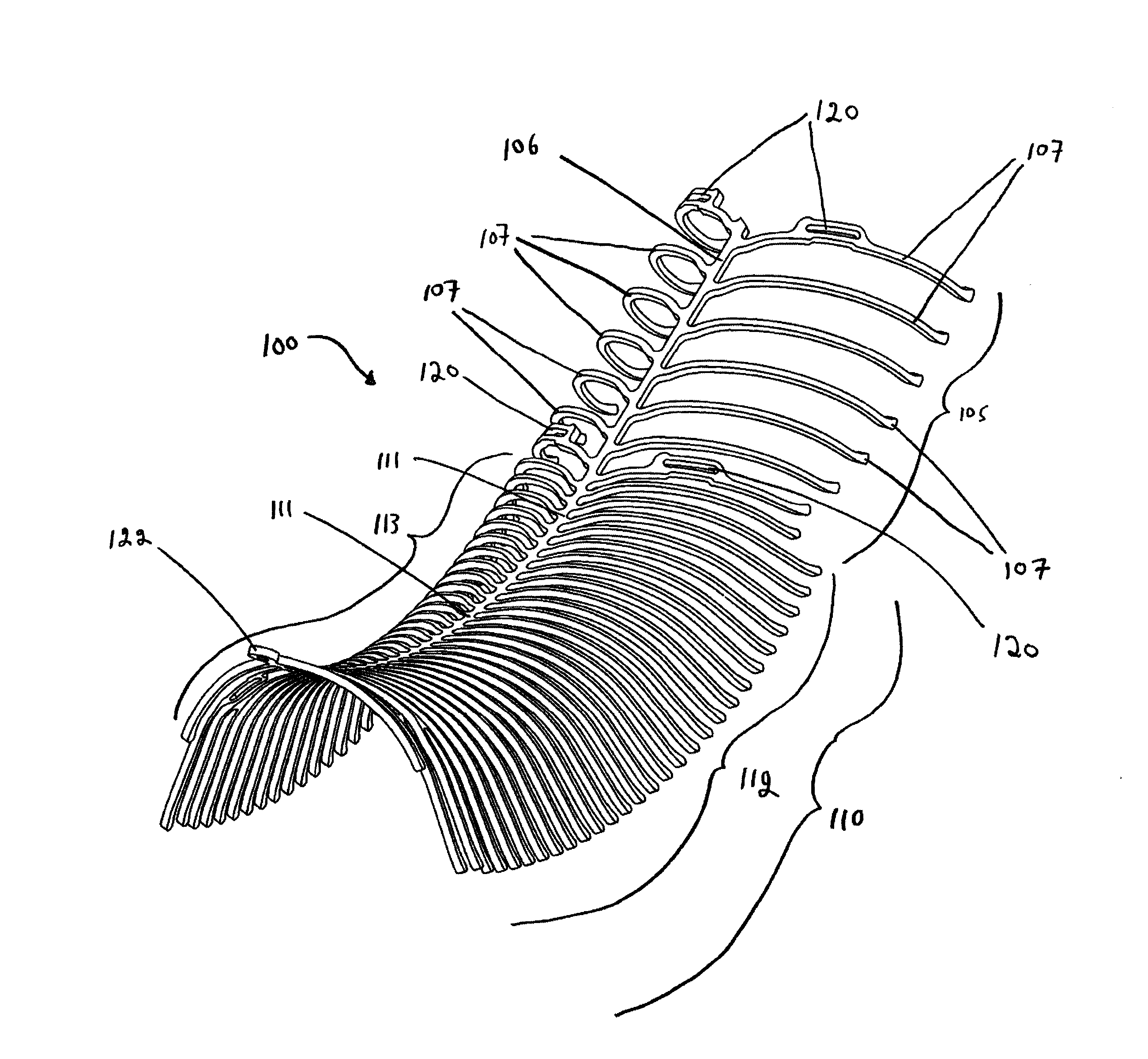 Endovascular prosthesis and method for delivery of an endovascular prosthesis