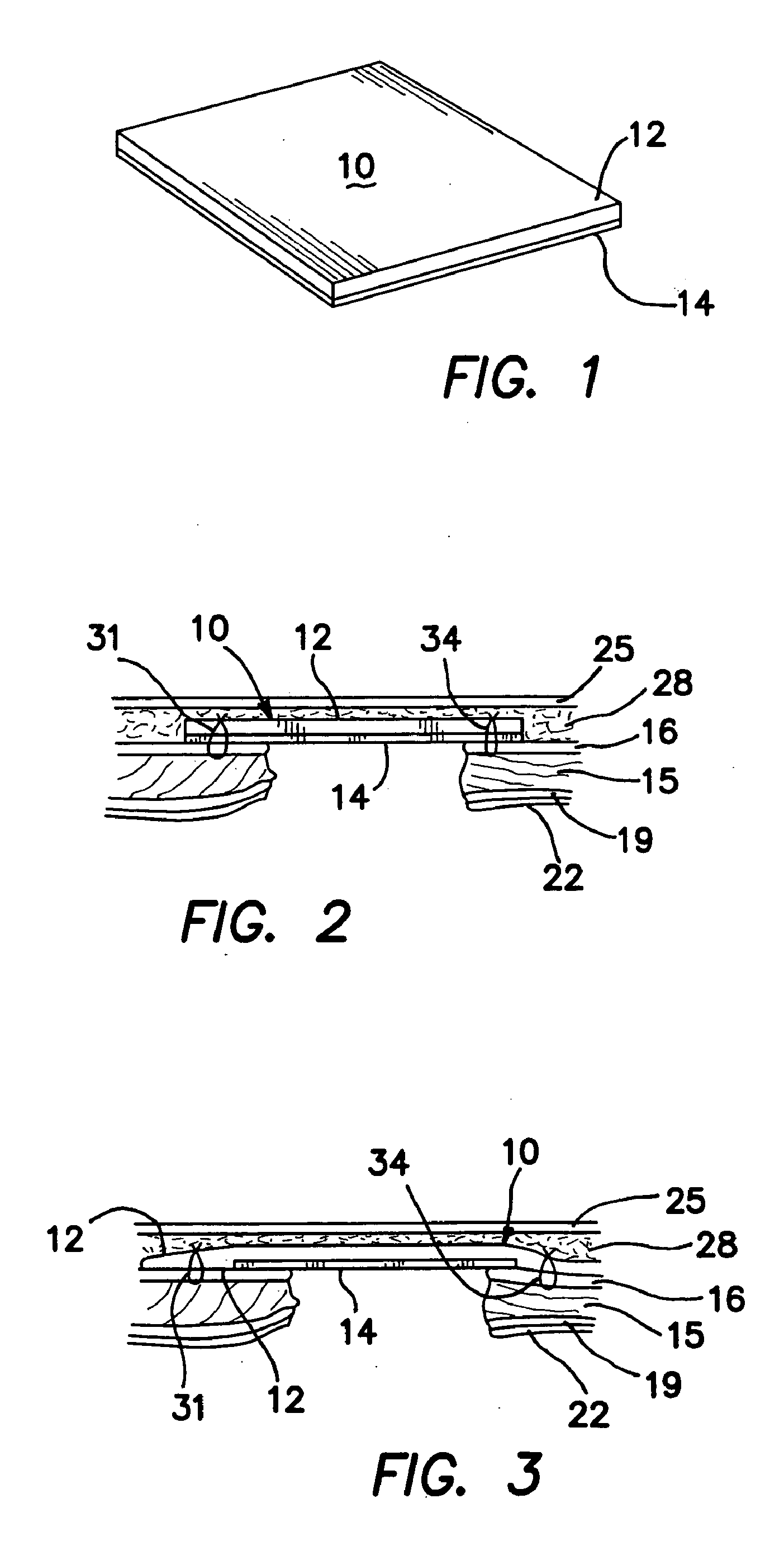 Surgical prosthesis having biodegradable and nonbiodegradable regions