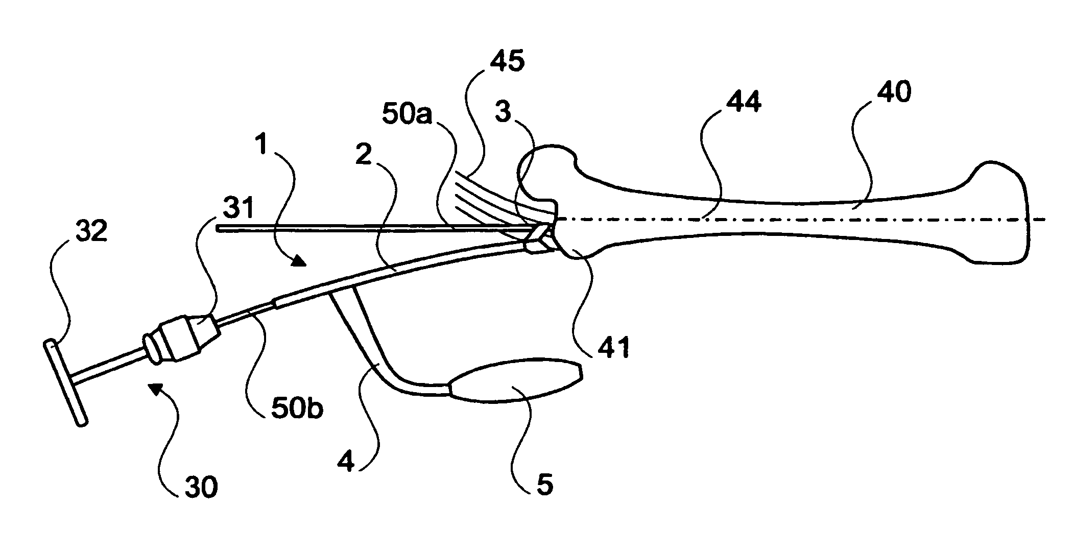 Curved positioning and insertion instrument for inserting a guide wire into the femur