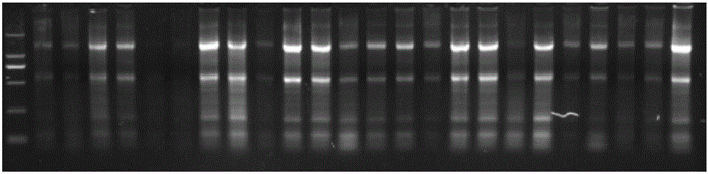 LAMP primer group CK19-115 for quickly detecting lymphatic metastasis of head and neck squamous cell carcinoma