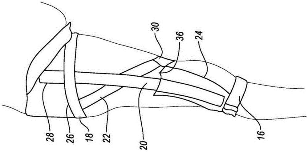 Orthopedic device for treating complications of the hip
