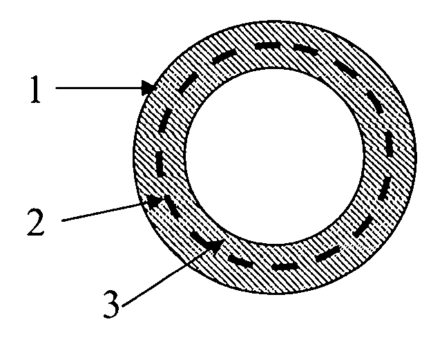 Bile duct support and preparation method thereof