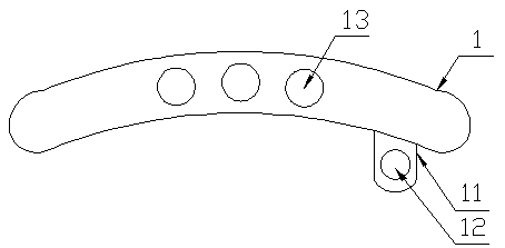 Acromioclavicular joint belt cross-linking combined bionic steel plate