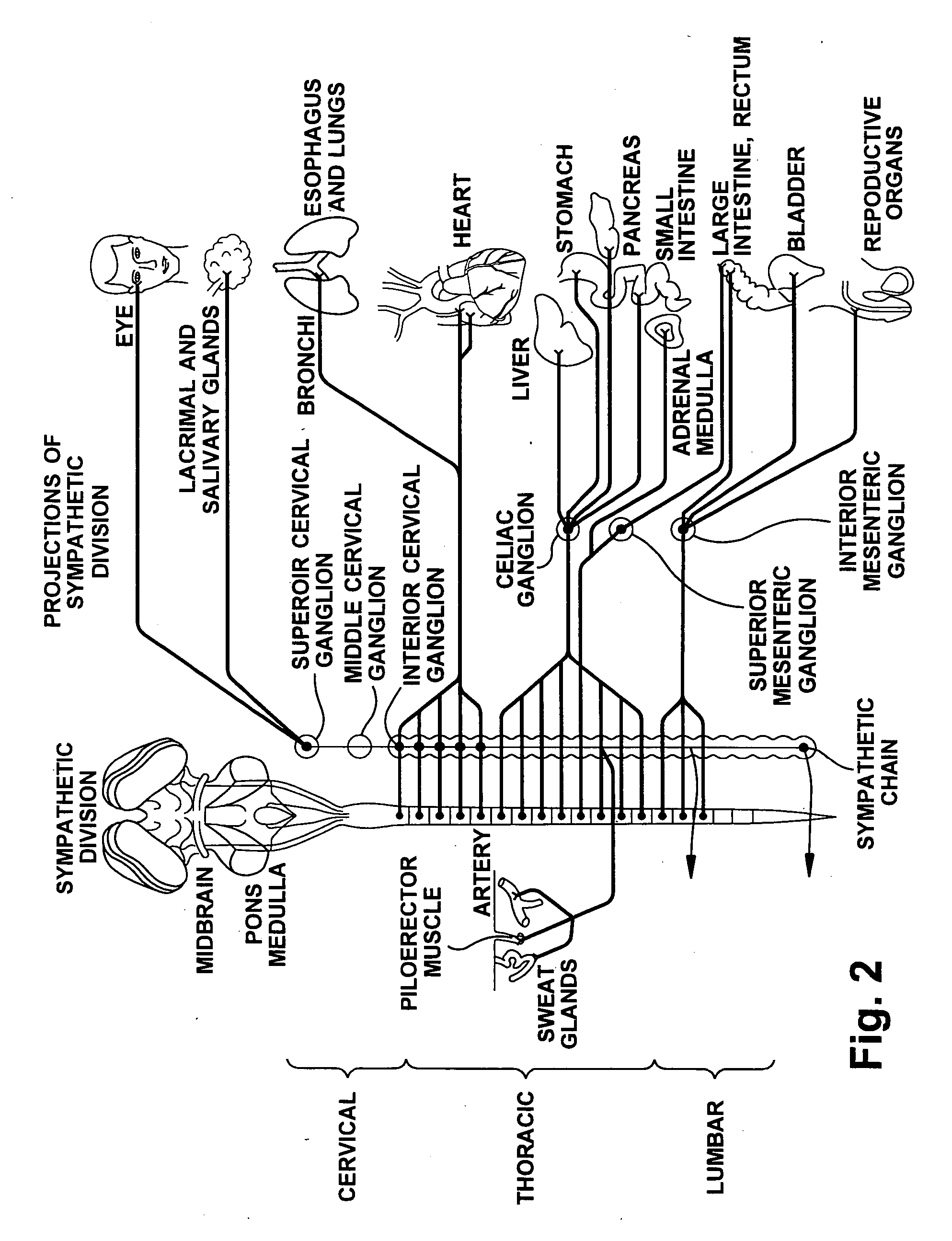 Apparatus and method for modulating the baroreflex system