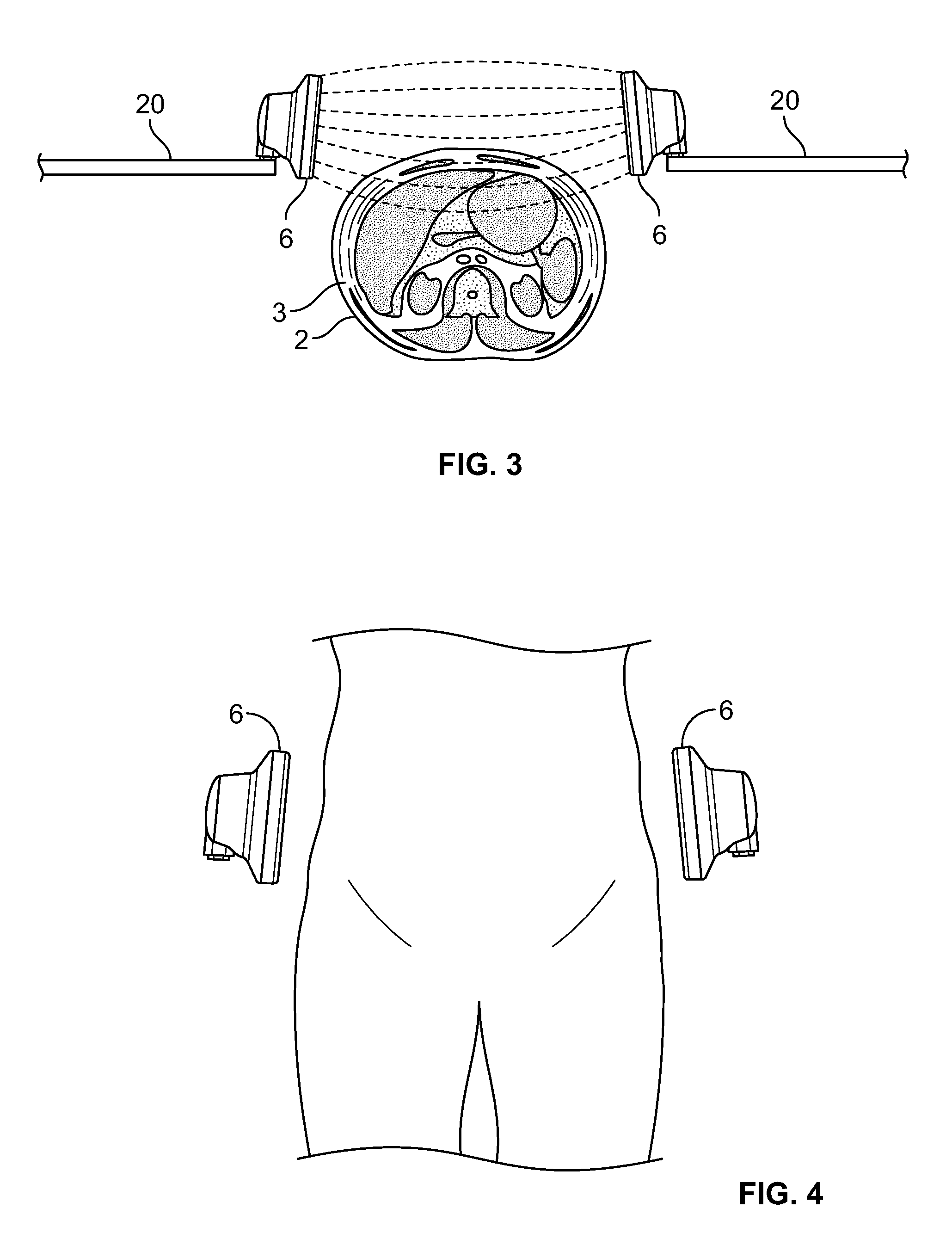 Methods and systems for subcutaneous treatments