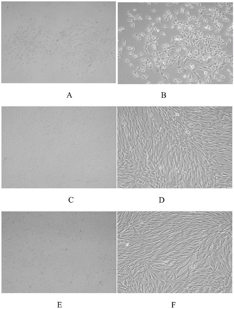 Periodontal ligament stem cells osteogenic differentiation inducing liquid and method
