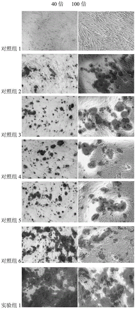 Periodontal ligament stem cells osteogenic differentiation inducing liquid and method