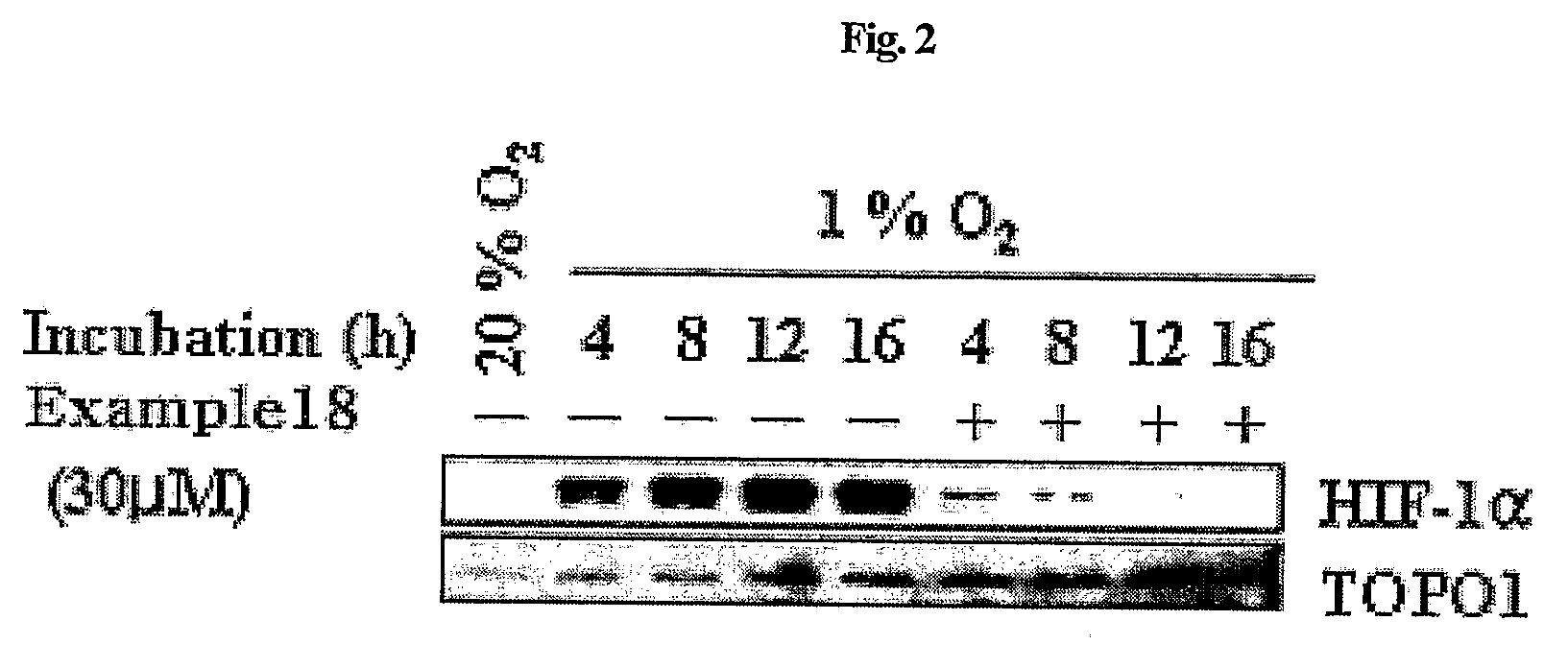 Compounds that inhibit hif-1 activity, the method for preparation thereof and the pharmaceutical composition containing them as an effective component