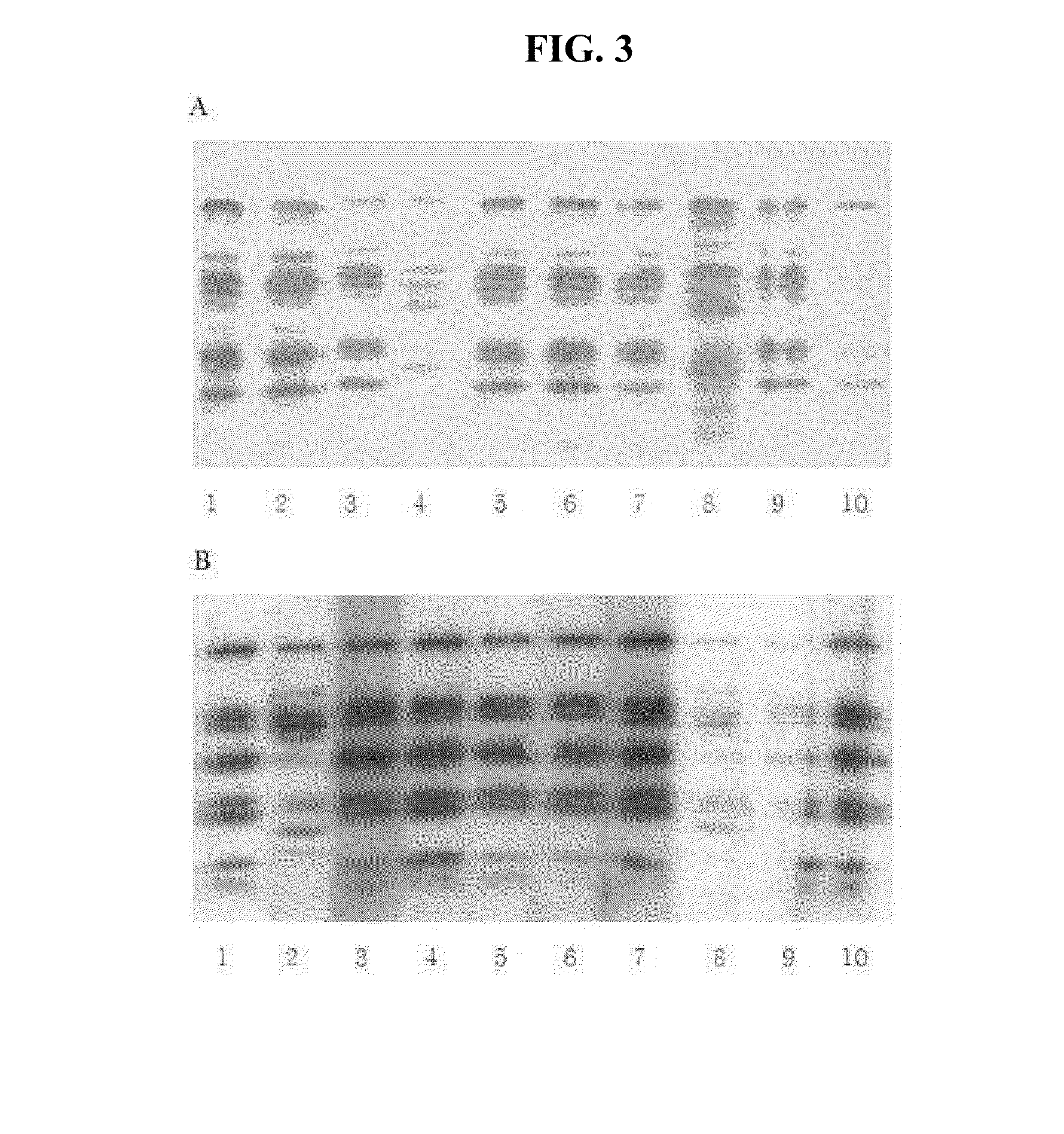 Kit and method for diagnosis, prognosis or monitoring of liver disease through measurement of amount of ast