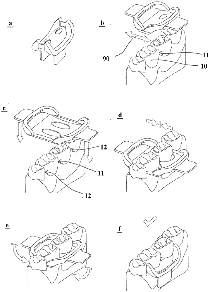 Device for shielding teeth to be treated