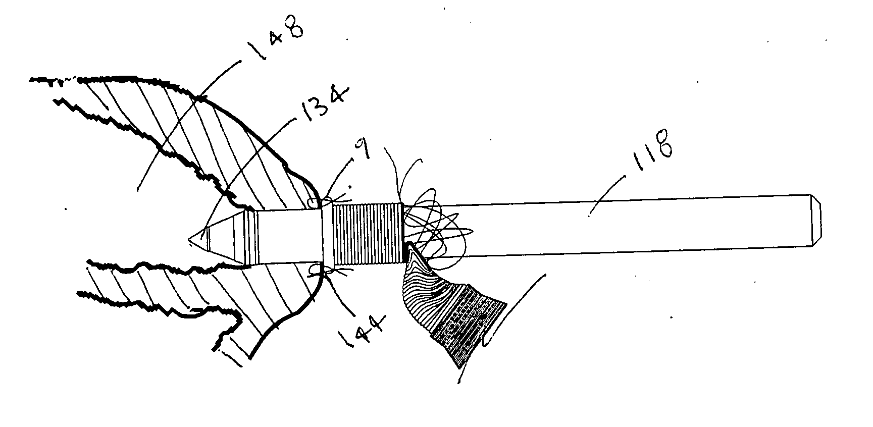 Valve bypass graft device, tools, and method