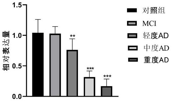 Biomarker for diagnosing Alzheimer's disease and progress of Alzheimer's disease and application of biomarker