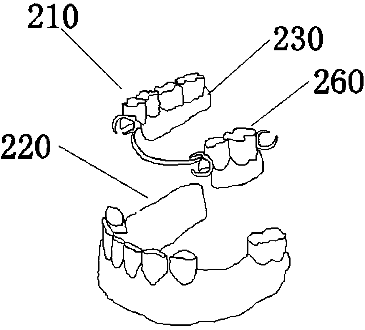 Secondary fine restoration method for denture