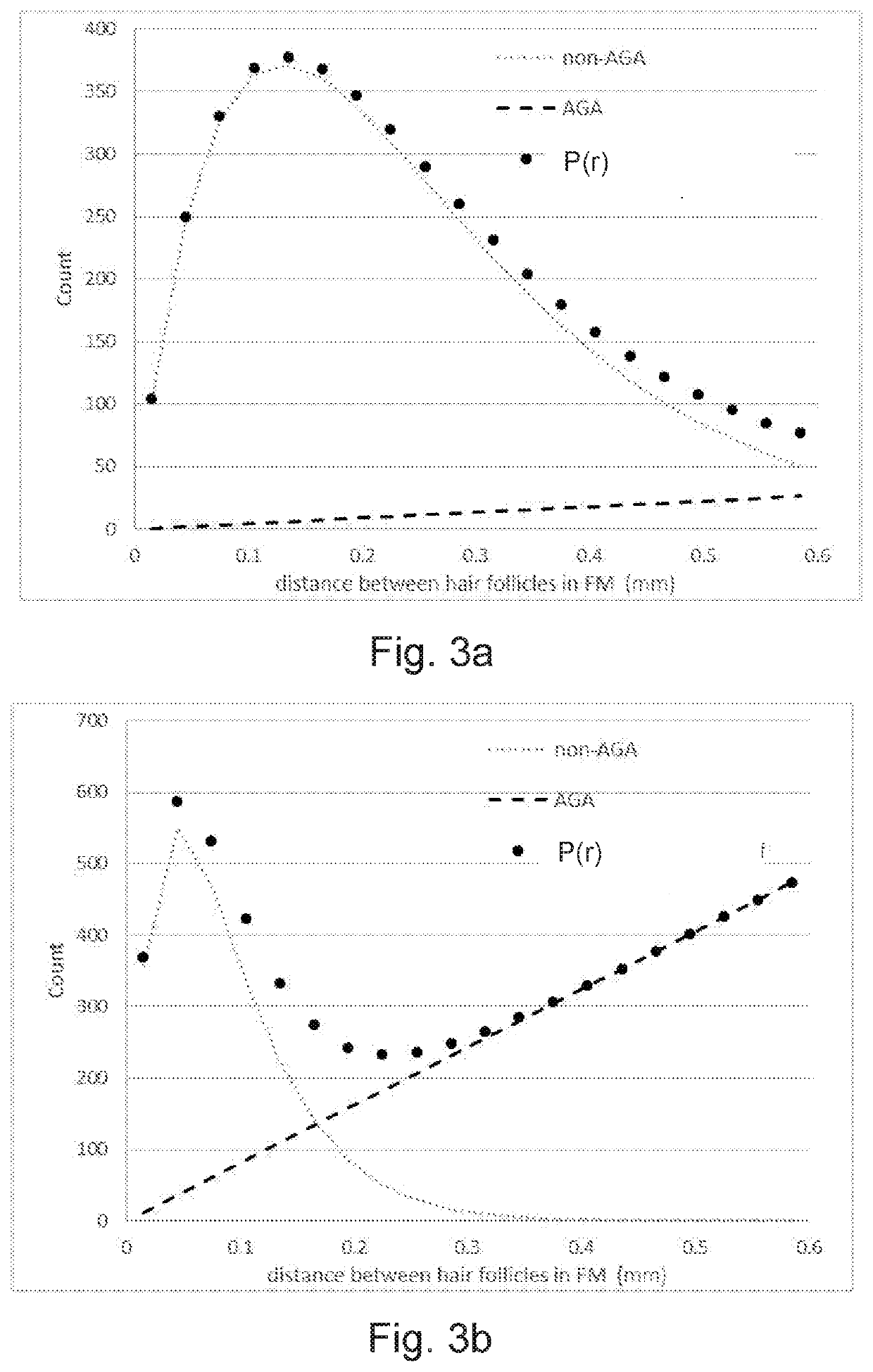 Analysis unit and system for assessment of hair condition