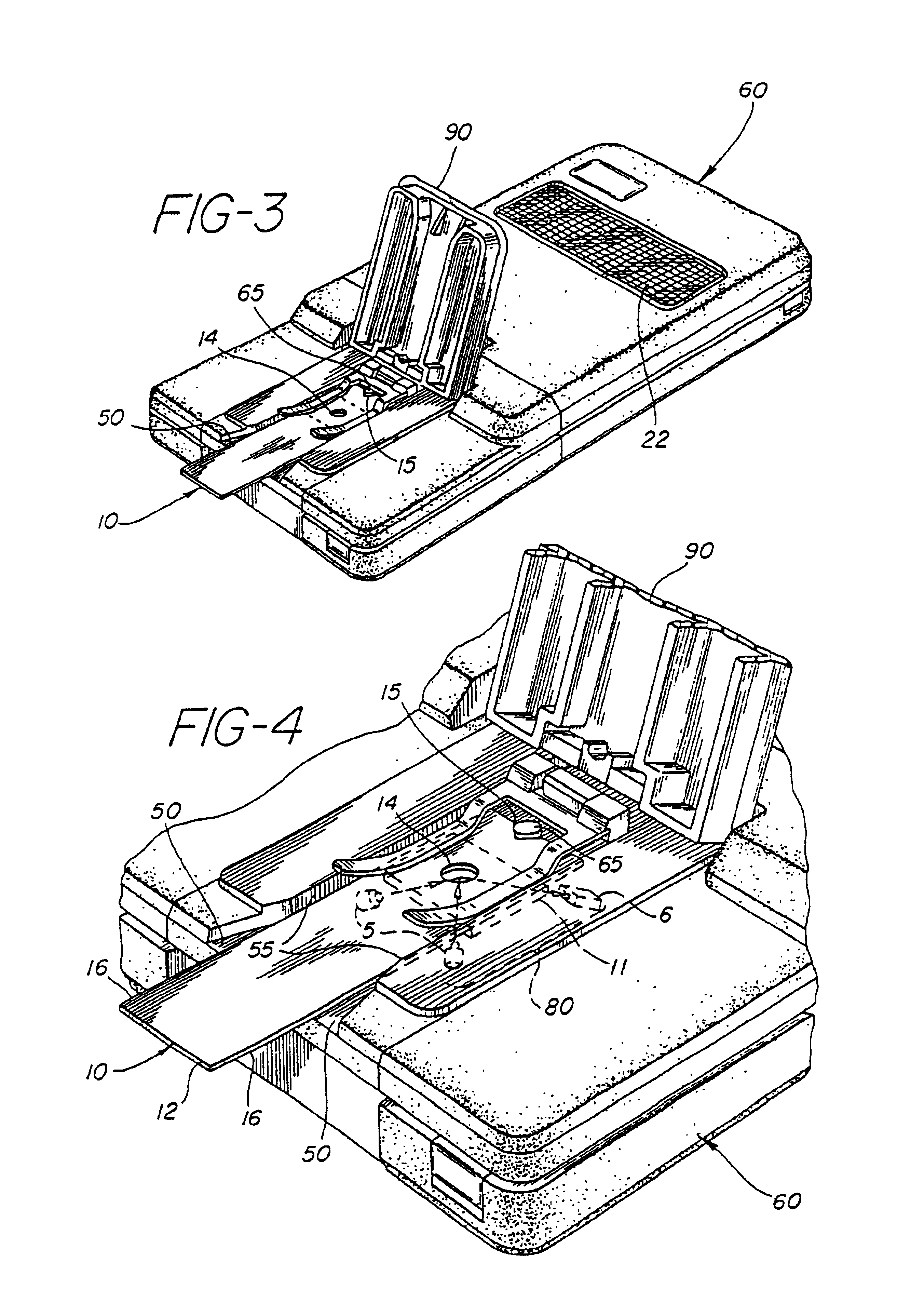Method for the determination of glucose employing an apparatus emplaced matrix