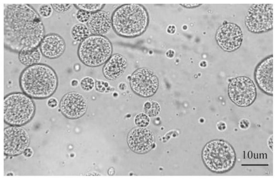 A kind of liraglutide multivesicular liposome and its preparation method and application