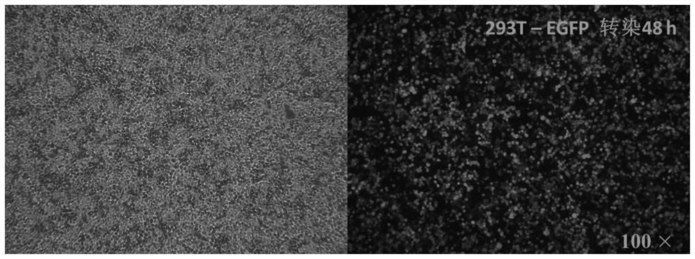 A chimeric antigen receptor, chimeric antigen receptor umbilical cord blood nucleated cells and application thereof