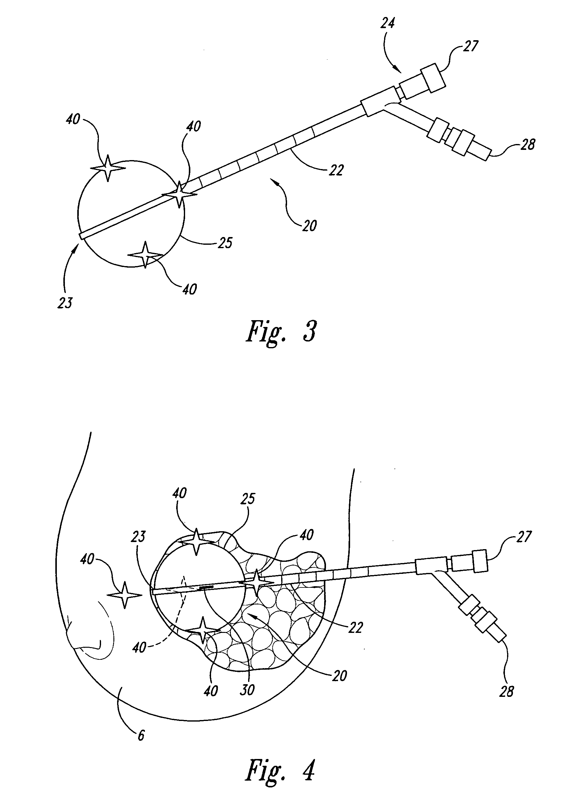 Systems and methods for treating a patient using radiation therapy