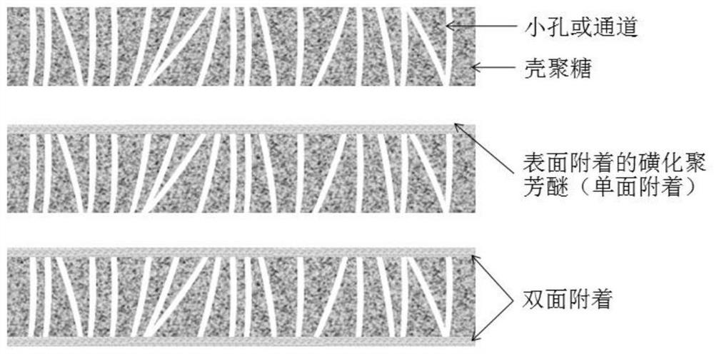 Chitosan-based composite membrane and preparation method thereof