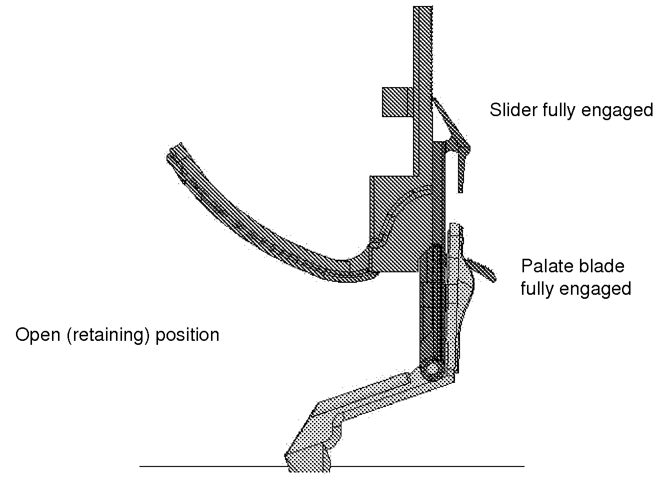 Laryngoscope