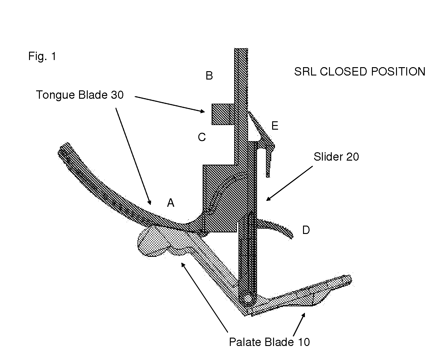 Laryngoscope