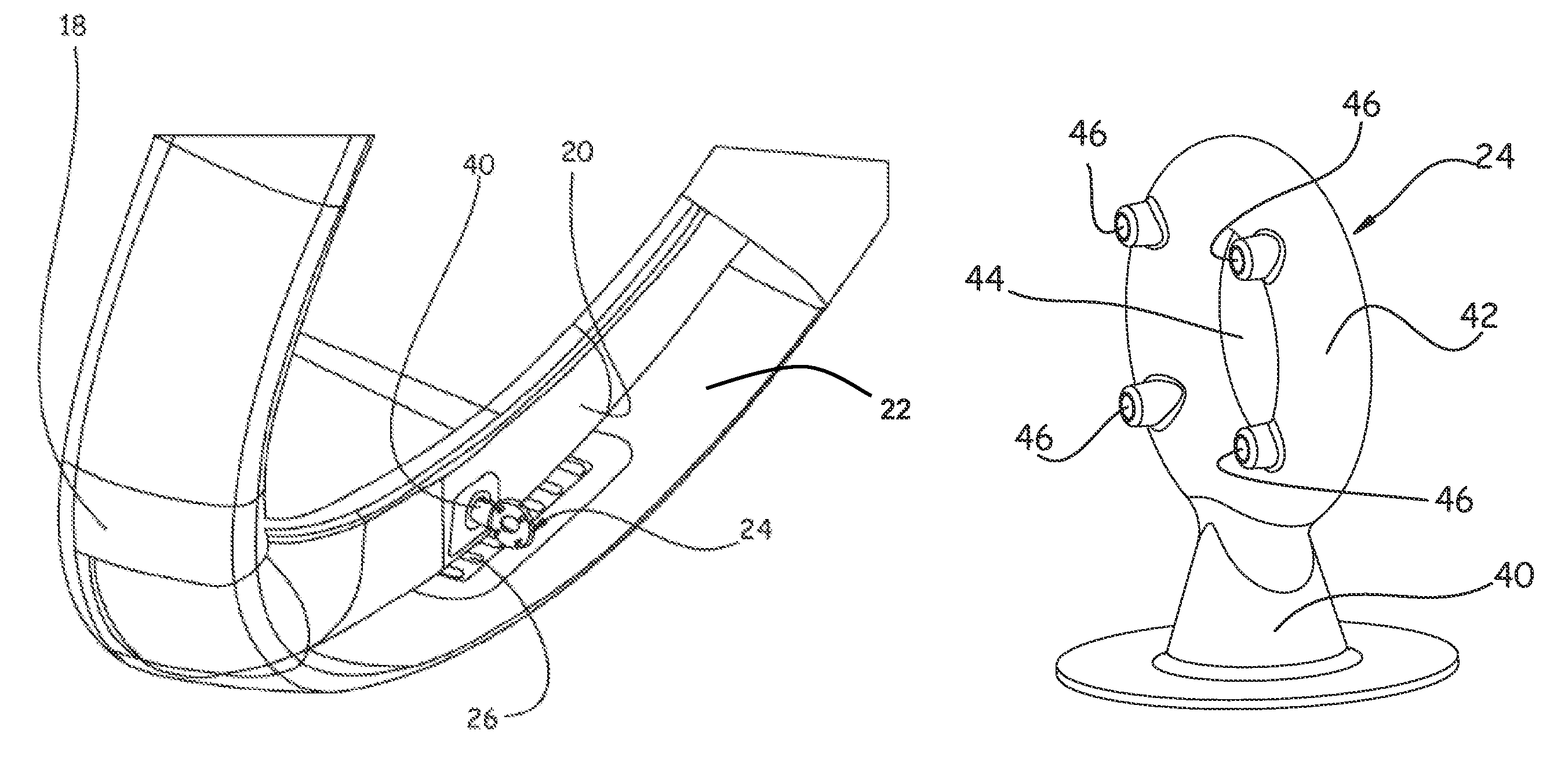 Aircraft nacelle air intake incorporating optimized ice-treatment hot air injection means