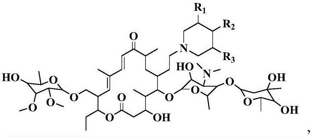 A kind of preparation method of tylosin macrolide and derivative thereof