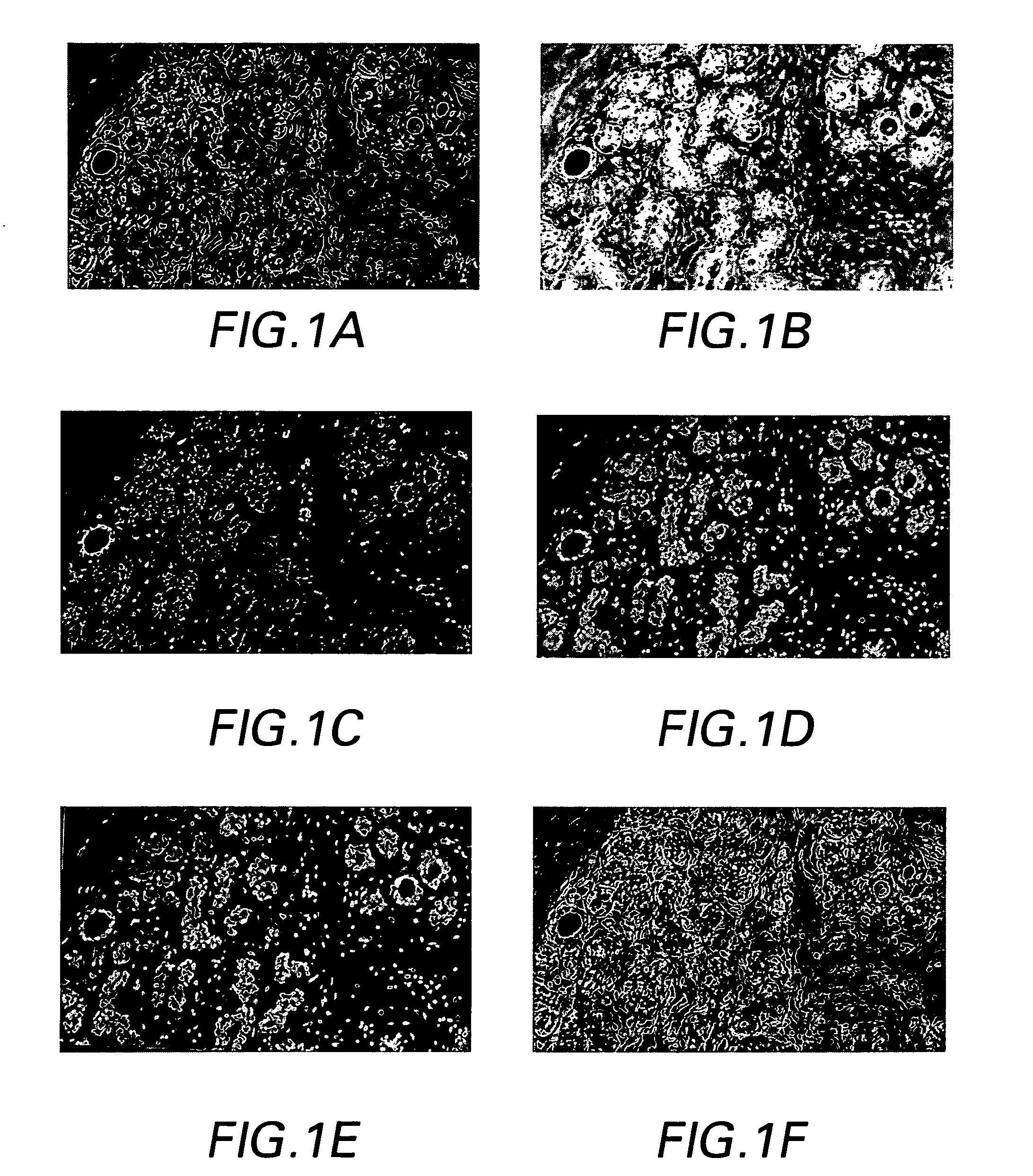 System and method for co-registering multi-channel images of a tissue micro array