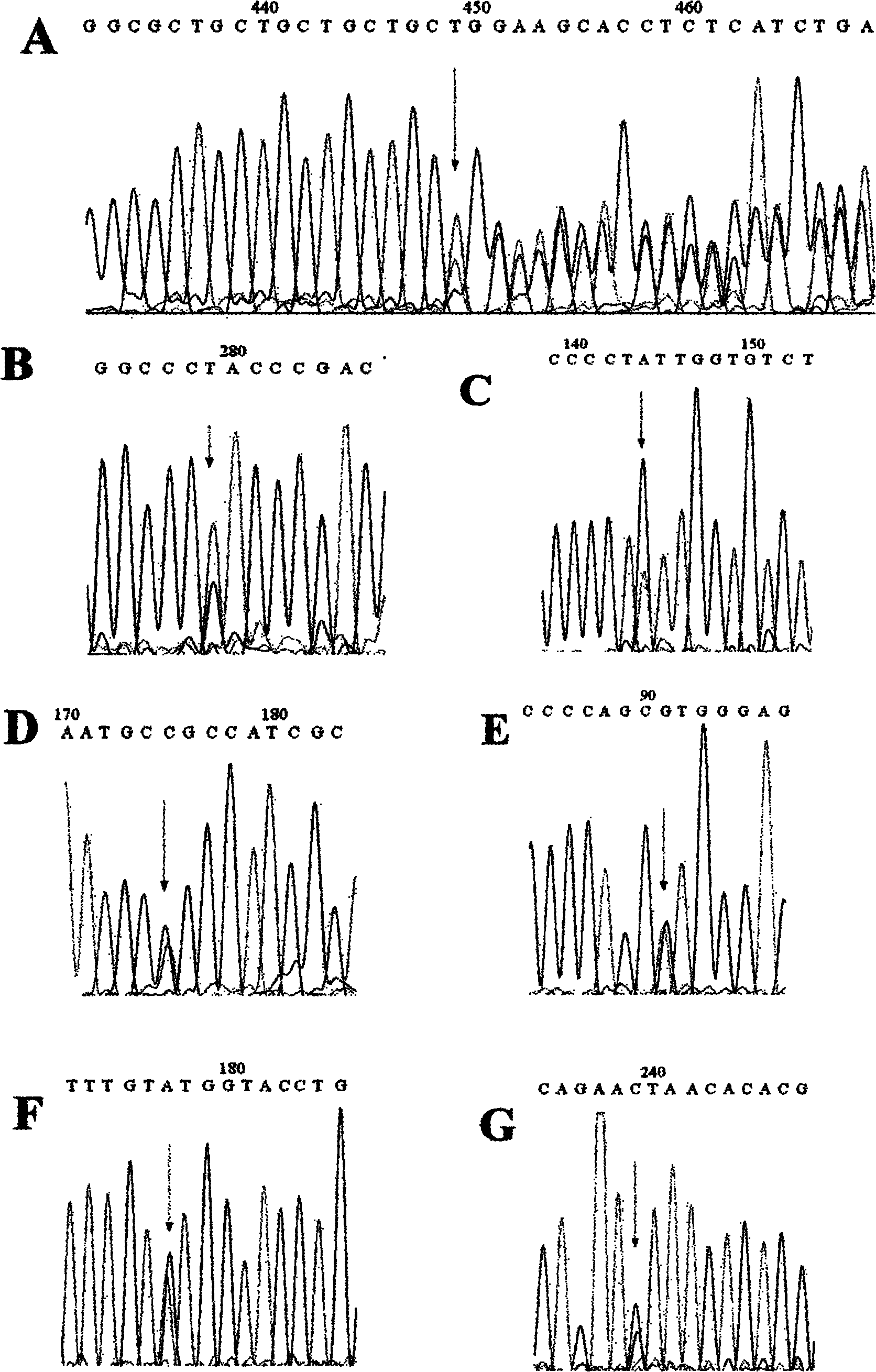 Epithelial type cadherin expressed gene CDH1 mutation detection kit and application thereof