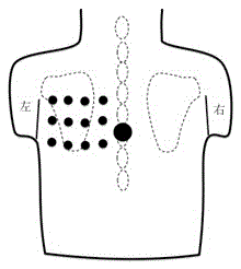 An electrocardiographic ultrasound signal fusion tomographic imaging system and method