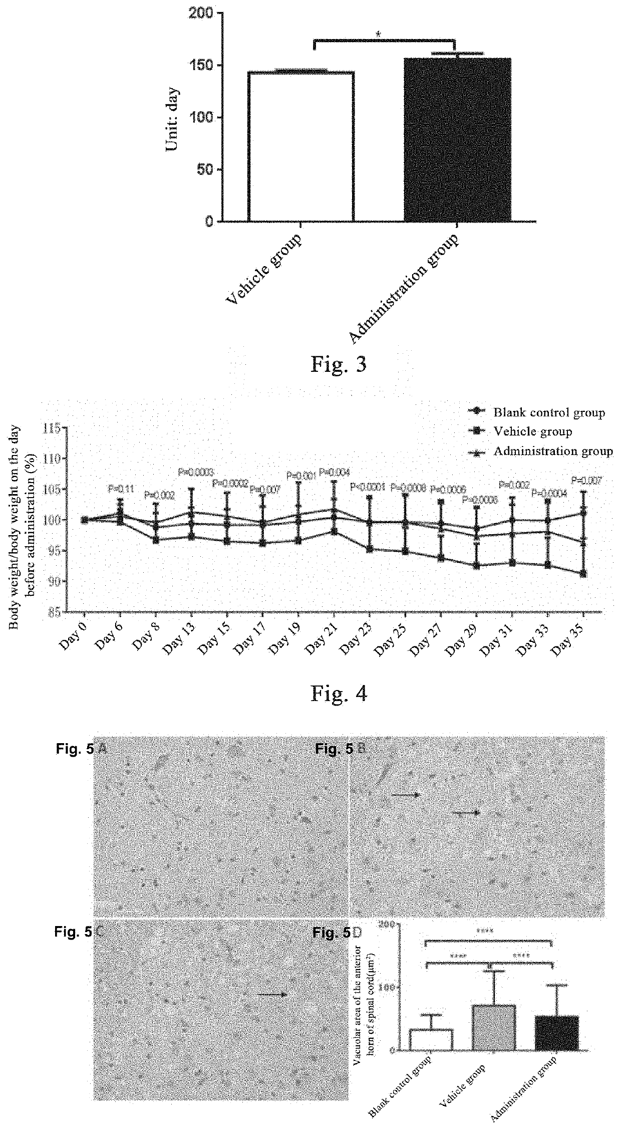 Method and medicine for treating amyotrophic lateral sclerosis